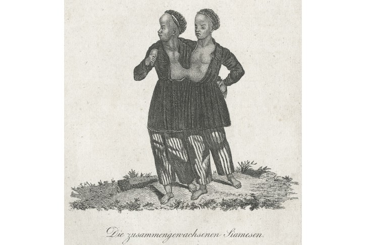 Siamská dvojčata, Medau, mědiryt , (1830)